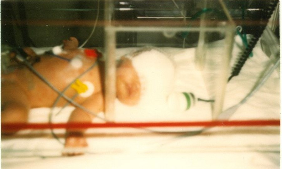 Jennifer as a tiny baby in an incubator, photo from the 1980's