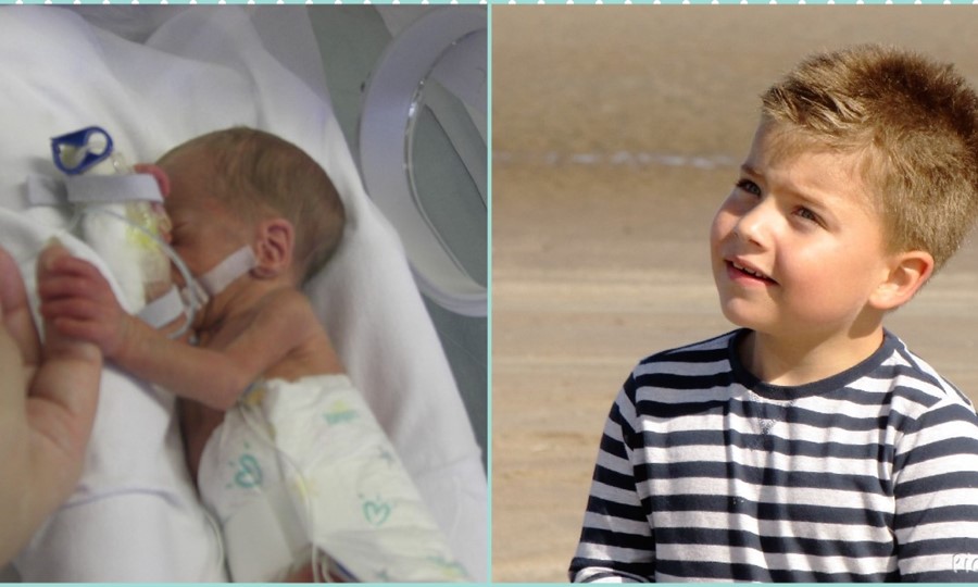 Two images - Luke as a premature baby in a hospital bed with tubes coming out him; and Luke as a healthy child.