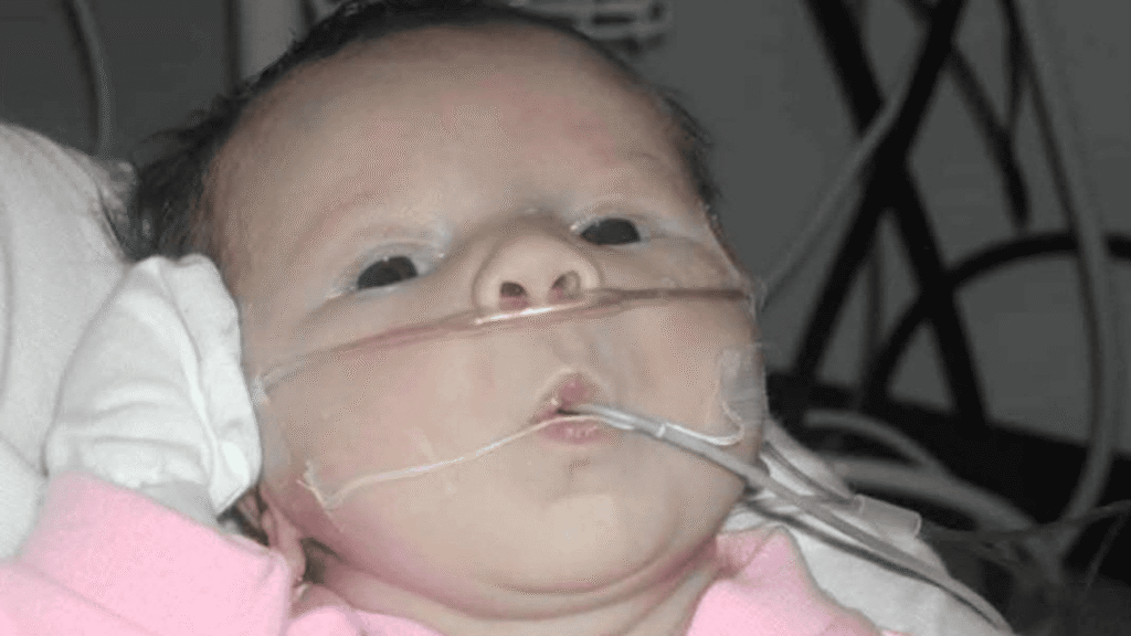 Sarah as a baby with tubes in her nose and mouth