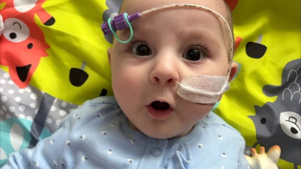 Baby ada with tubes in her nose but looking very happy and healthy