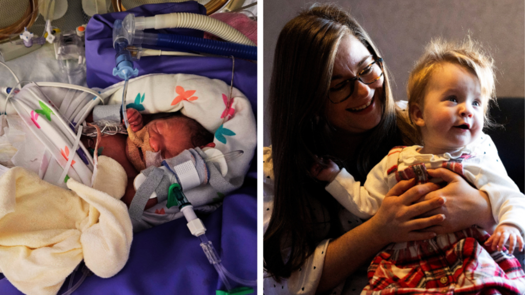 Two pics of Alexandra side by side: Alexandria as a baby with lots of tubes coming out of her; and today happy and healthy with mum Nicolle.